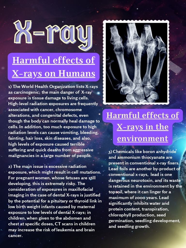 XRay Harmful Effects of XRays On Humans Download Free PDF Ultraviolet Gamma Ray