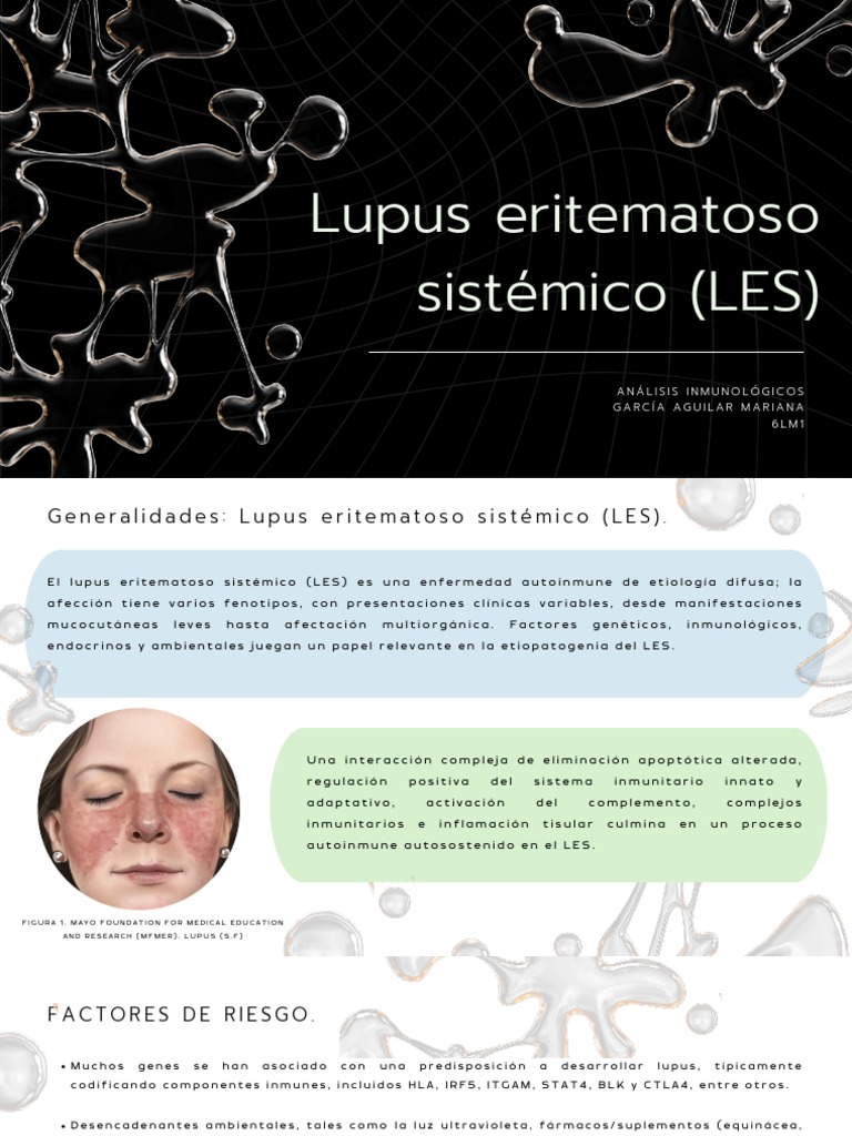 Lupus Eritematoso Sistémico (LES) : Análisis Inmunológicos García ...