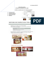 2 - Metodo de Dx de Caries