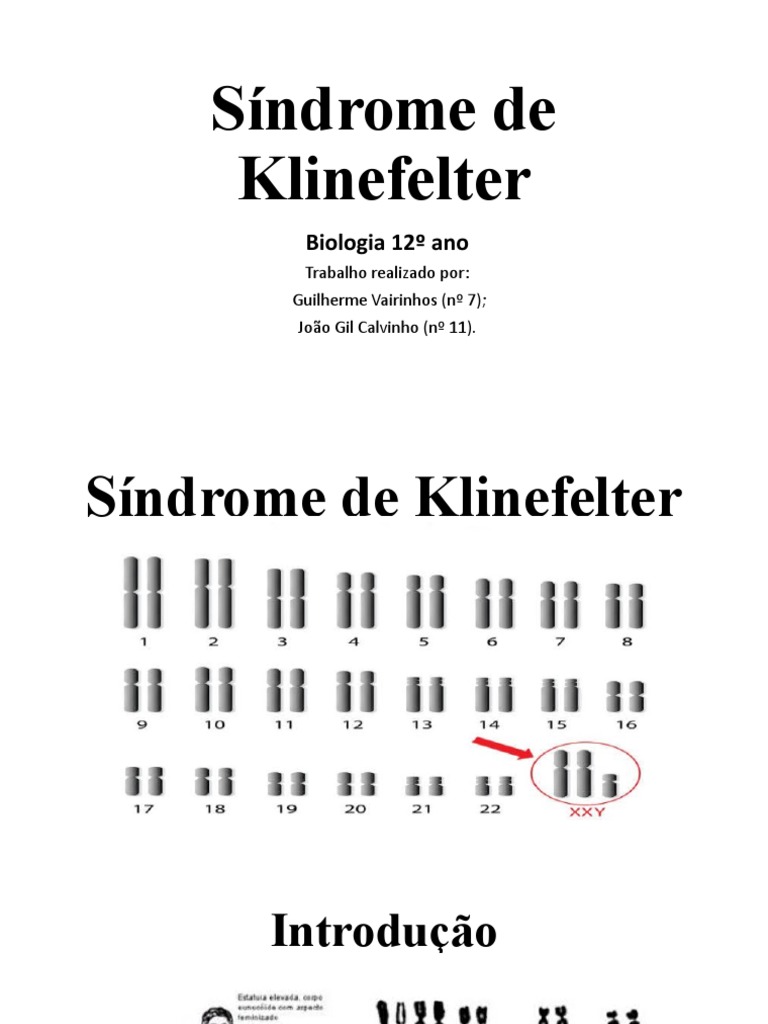 Síndrome de Klinefelter | PDF