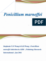 Penicillium Marneffei Infection in HIV/AIDS Patients