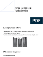 Chronic Periapical Periodontitis