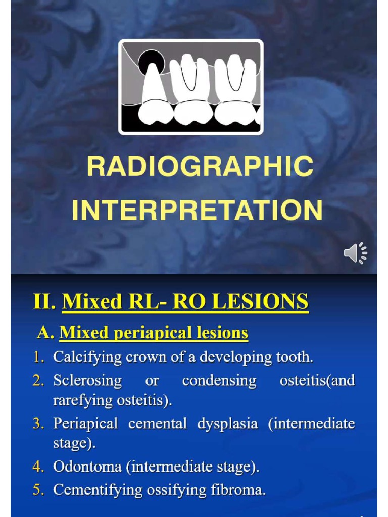 19mixed and radioopaque PDF