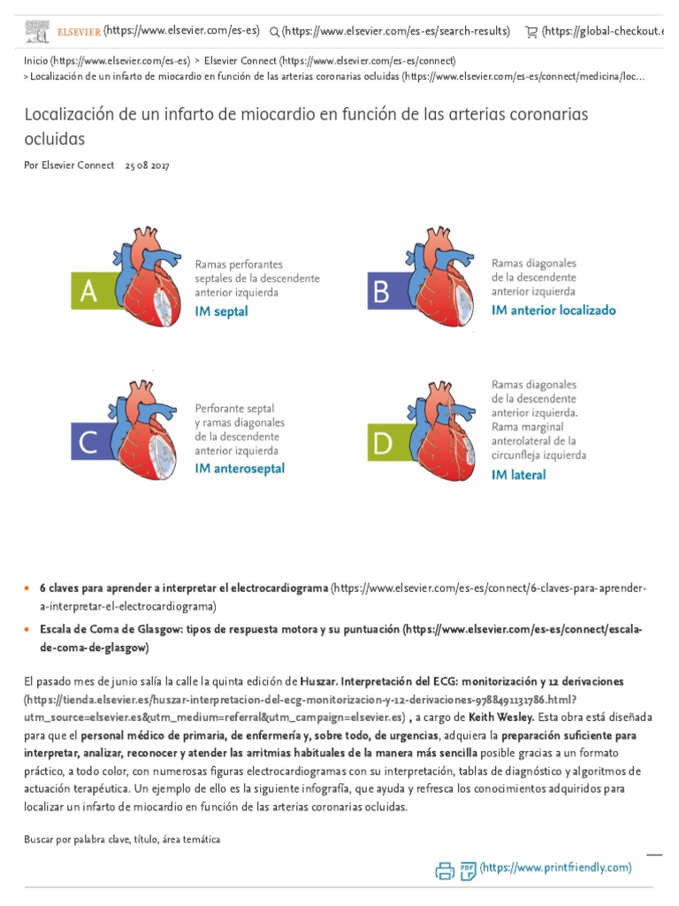 Localización de Un Infarto de Miocardio en Función de Las Arterias ...