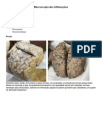 Macroscopia Das Inflamações