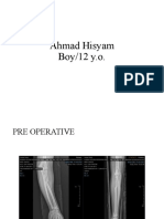 Post Op PEDI Ahmad Hisyam Final