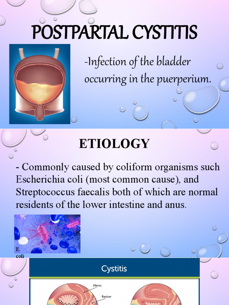 Postpartal Cystitis Overview | PDF | Science & Mathematics