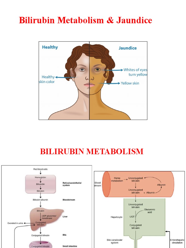 32 jaundice vand rxn and bilirubin metabolism pdf