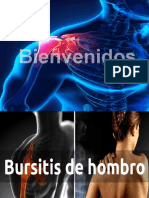 Bursitis en Hombro