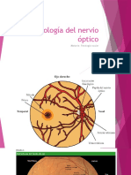 Patología Del Nervio Óptico