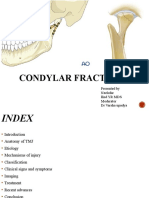 Condylar Fracture - 2