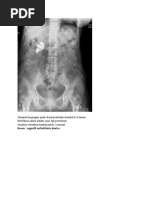 Gambaran Normal dan Patologis BNO Abdomen | PDF