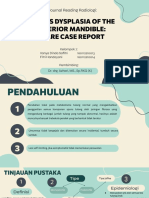(Revisi) Kel 7 - Fibrous Dysplasia of Anterior Mandible - A Rare Case Report