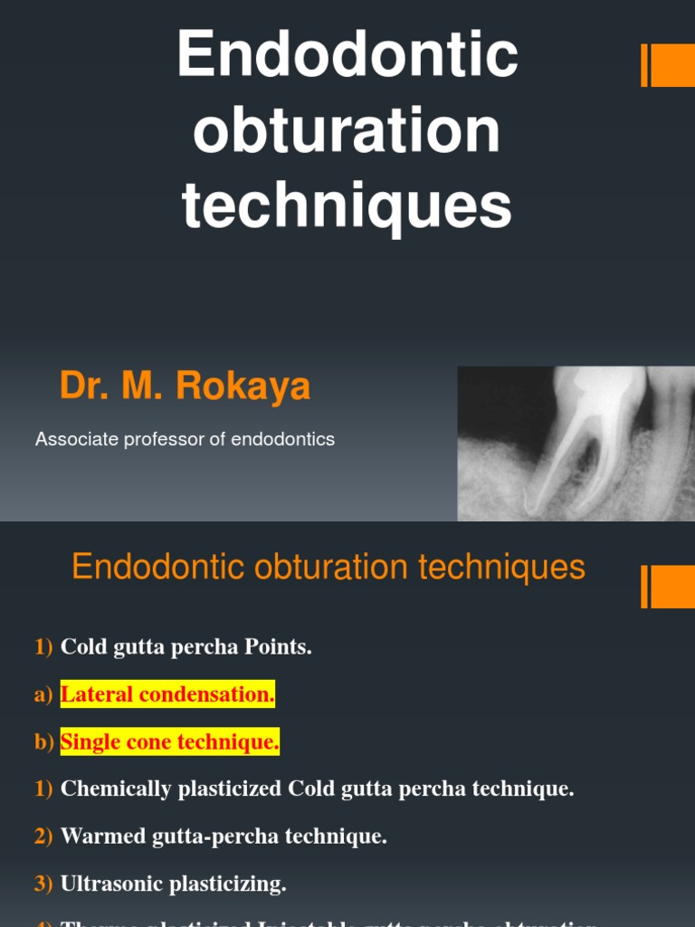 Endodontic Obturation Techniques Overview | PDF