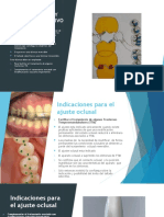 Ajuste Oclusal y Desgaste Selectivo