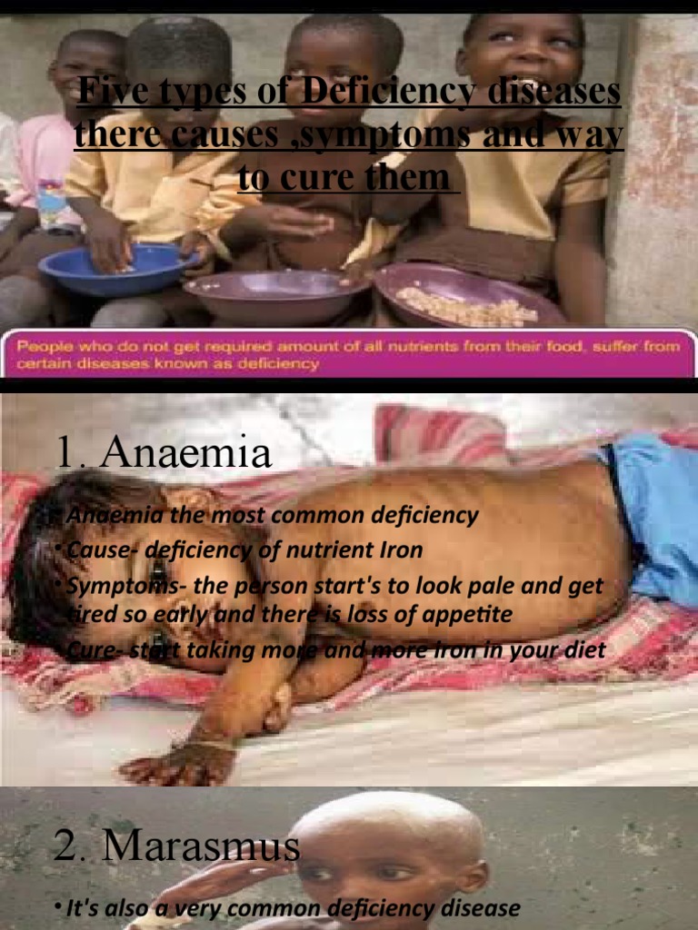 Nutrient Deficiency Guide | PDF