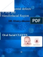 Developmental Defects of Oral and Maxillofacial Region