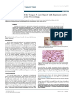 Granular Cell Tumor of The Tongue A Case Report With Emphasis On Thediagnostic and Therapeutic Proceedings OCCRS 1000106