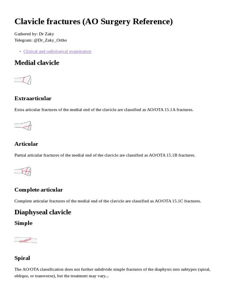 Clavicle AO Surgery Reference (2023) | PDF | Anatomical Terms Of Motion ...
