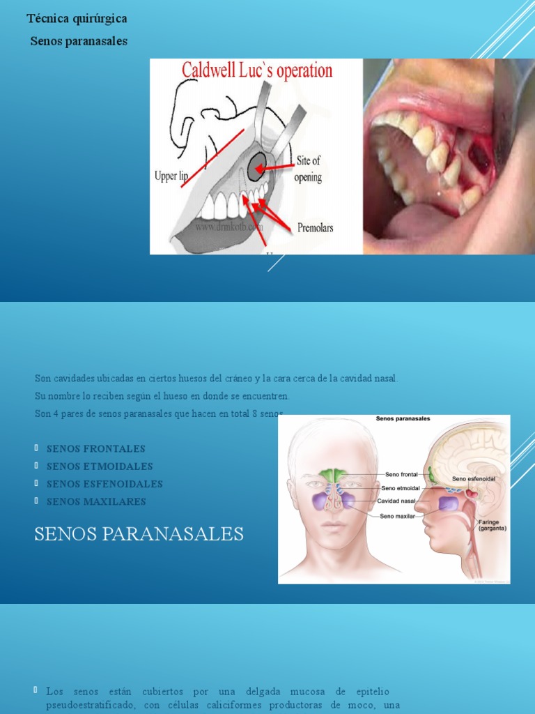 6.caldwell-Luc Corregido (5008) | PDF | Cabeza y cuello humanos