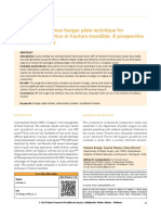 Erich Arch Bar Versus Hanger Plate Technique For Intermaxillary Fixation in Fracture Mandible