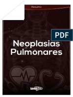Neoplasia Pulmonar