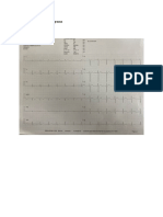 Informe de Electrocardiograma