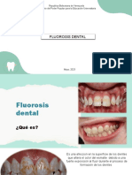 Fluorosis Dental 1