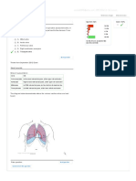 A. Mitral Valve B. Aortic Valve C. Pulmonary Valve D. Right Ventricular Aneurysm