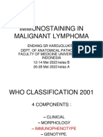Immunostaining in Malignant Lymphoma Kelas B