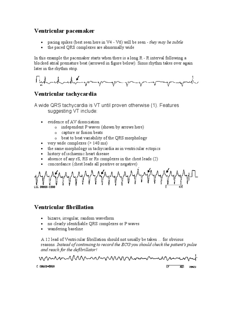 Heart Rhythms | PDF | History