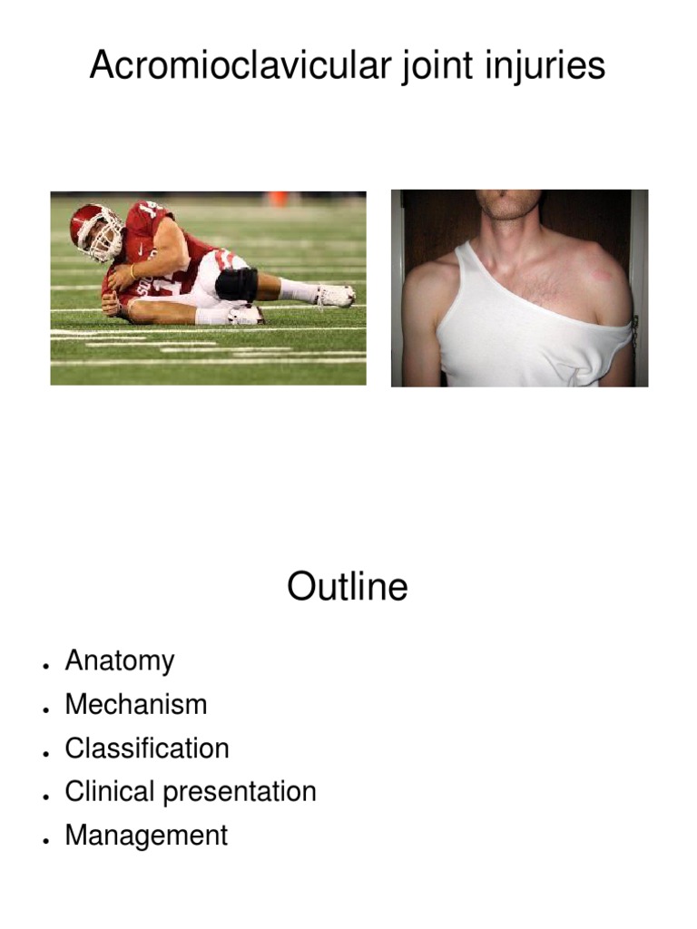 AC Joint PDF Musculoskeletal Disorders Limbs (Anatomy)