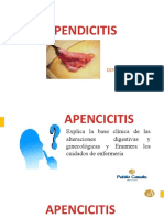 Apendicitis