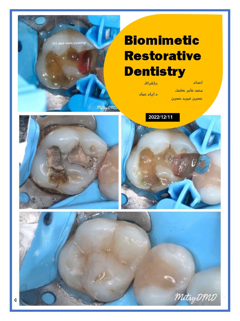 Biomimetic Restorative Dentistry | PDF | Tooth Enamel | Dentin