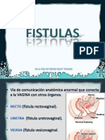 Fistulas 120215183848 Phpapp02