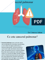Cancerul Pulmonar