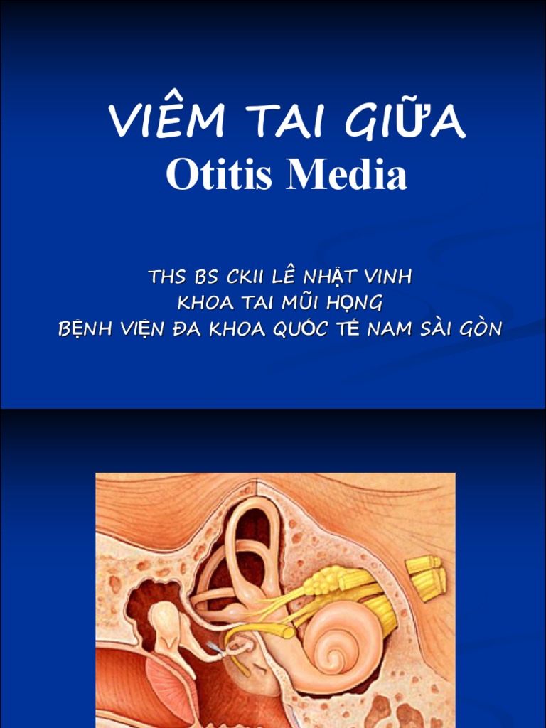 Viêm Tai Gi A | PDF