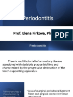 Periodontitis - Clinical