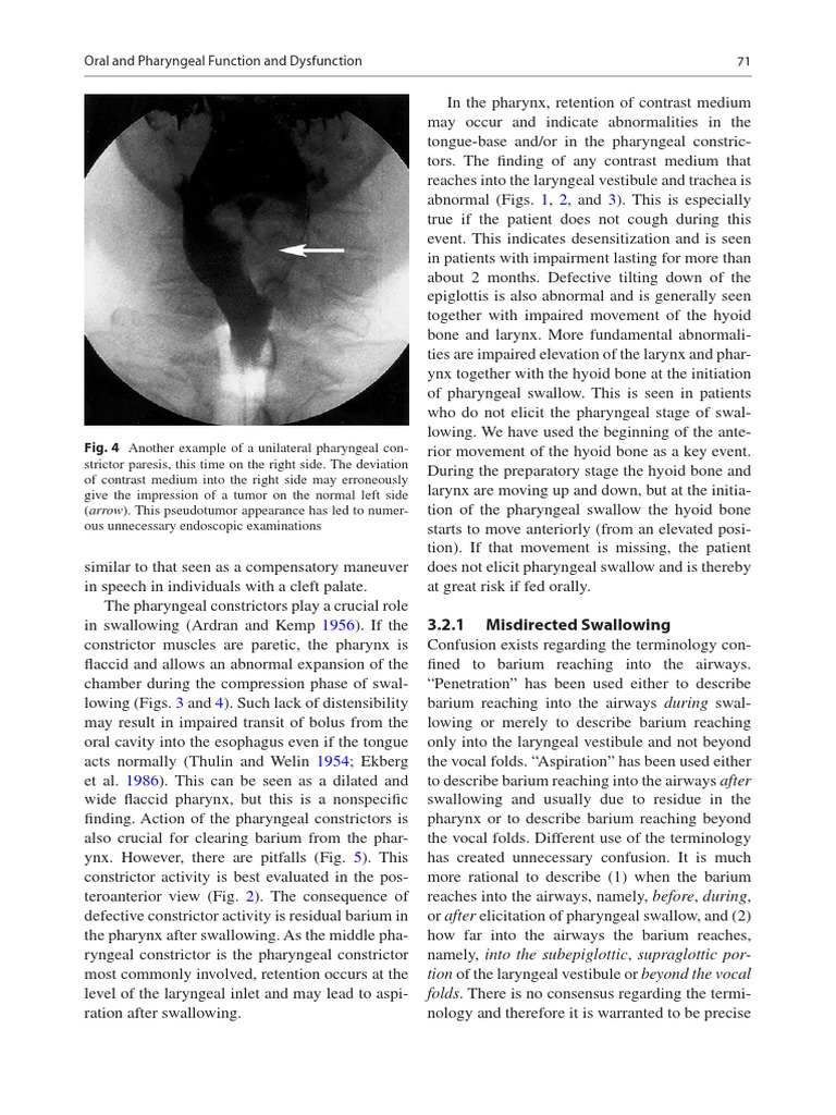 Dysphagia Diagnosis 1and Treatment (Olle Ekberg) (Z-Lib - Org) (1) - 83-284  | PDF | Larynx | Diseases And Disorders, image size:768x1024