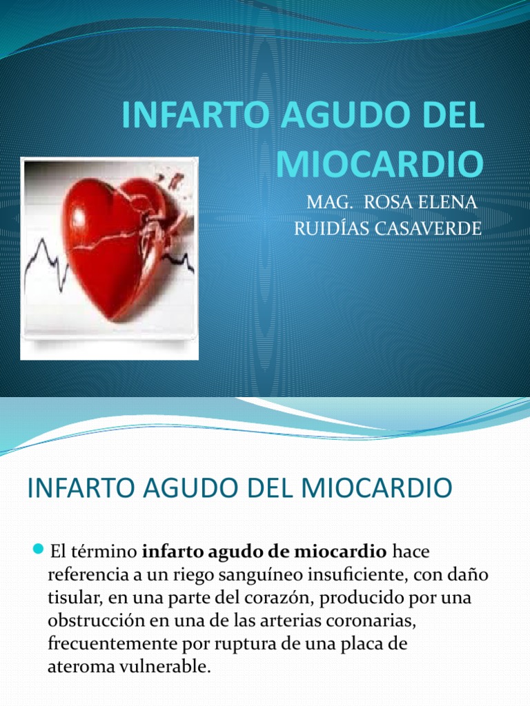 Infarto Agudo Del Miocardio | PDF | Infarto de miocardio | Corazón