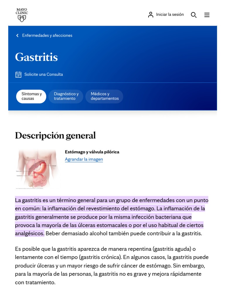 Gastritis Síntomas y Causas Mayo PDF Indigestión Medicina CLINICA