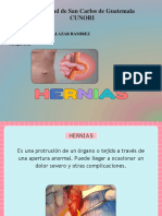 Hernias