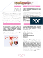 Cáncer de Vagina