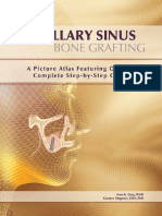 Maxillary Sinus Bone Grafting