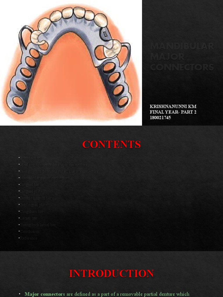 Mandibular Major Connectors PDF Dentistry Mouth