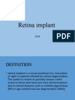 Retina Implant