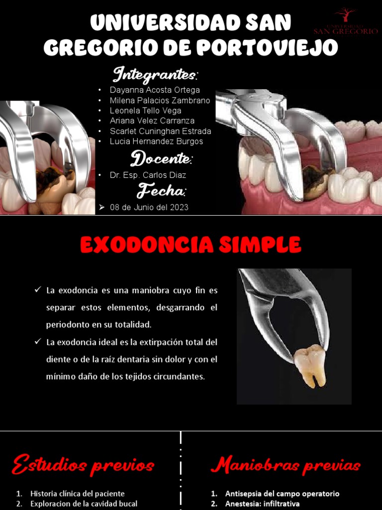 Protocolo de Exodoncia Simple | PDF | Diente | Anestesia