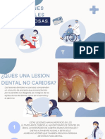 Lesiones Dentales: No Cariosas