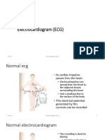 Electrocardiogram (ECG)