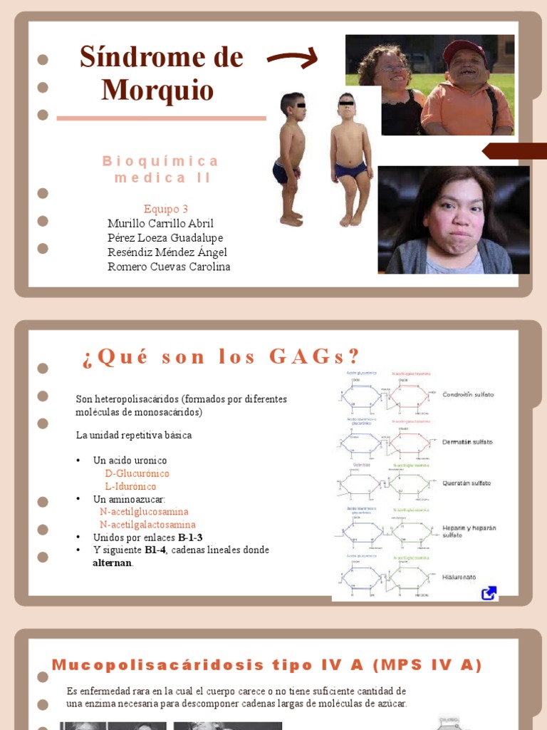Síndrome de Morquio: MPS IV A y B | PDF | Medicina CLINICA ...